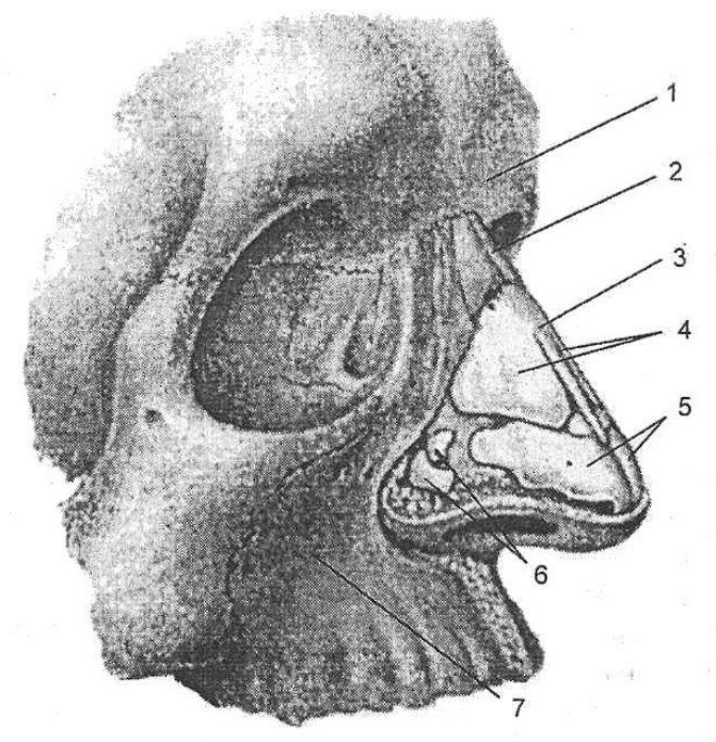 Анатомия носа и околоносовых пазух