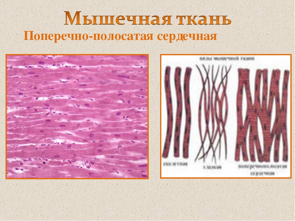 Изображение поперечно полосатой мышечной ткани. Поперечнополосатая сердечная мышечная ткань. Поперечно-полосатая ткань сердечной мышцы. Поперечнополосатая сердечная мышечная ткань рисунок. Поперечно полосатая мышечная ткань рыхлая соединительная ткань.