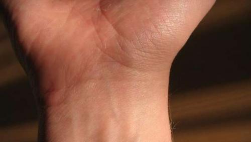 Анатомия связки руки. Кости кисти руки