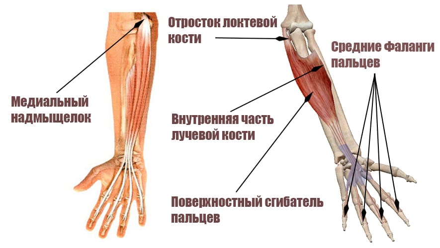 Сгибатели кисти. Поверхностный сгибатель пальцев анатомия. Поверхностный сгибатель пальцев кисти. Сгибатели кисти и пальцев мышца функции. Поверхностный сгибатель пальцев кисти анатомия.