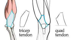 triceps tendon vs quad tendon